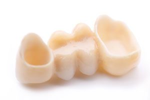 hambaproteesid sillad