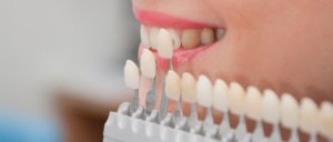 hammaste valgendamine tartus
